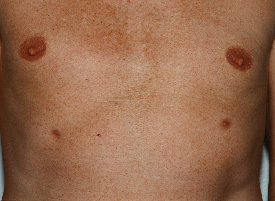Accessory Nipples